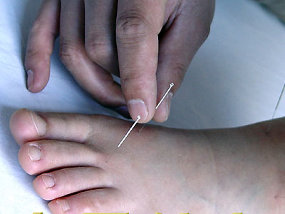 Popular and Useful Treatment